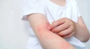 9 Types of Body Itching That May Indicate Serious Health Issues