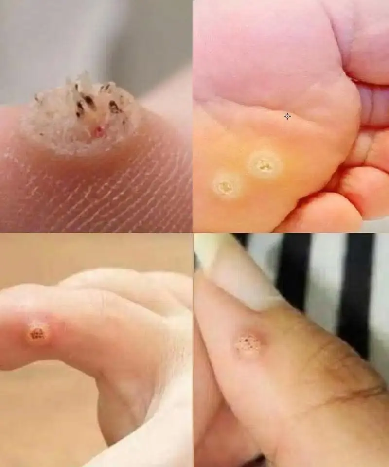 Pay Close Attention: This Type of Skin Growth Could Be a Warning Sign of a More Serious Condition