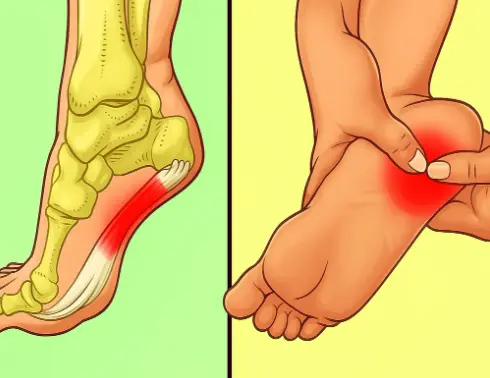 7 Exercises That Can Help Relieve Heel Pain Fast