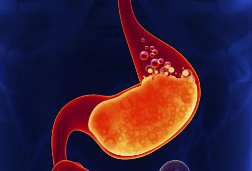 7 symptoms after eating that experts say could signal late-detected stomach can.cer
