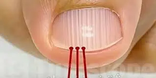 Over 40? These Nail Lines Might Signal Something Important