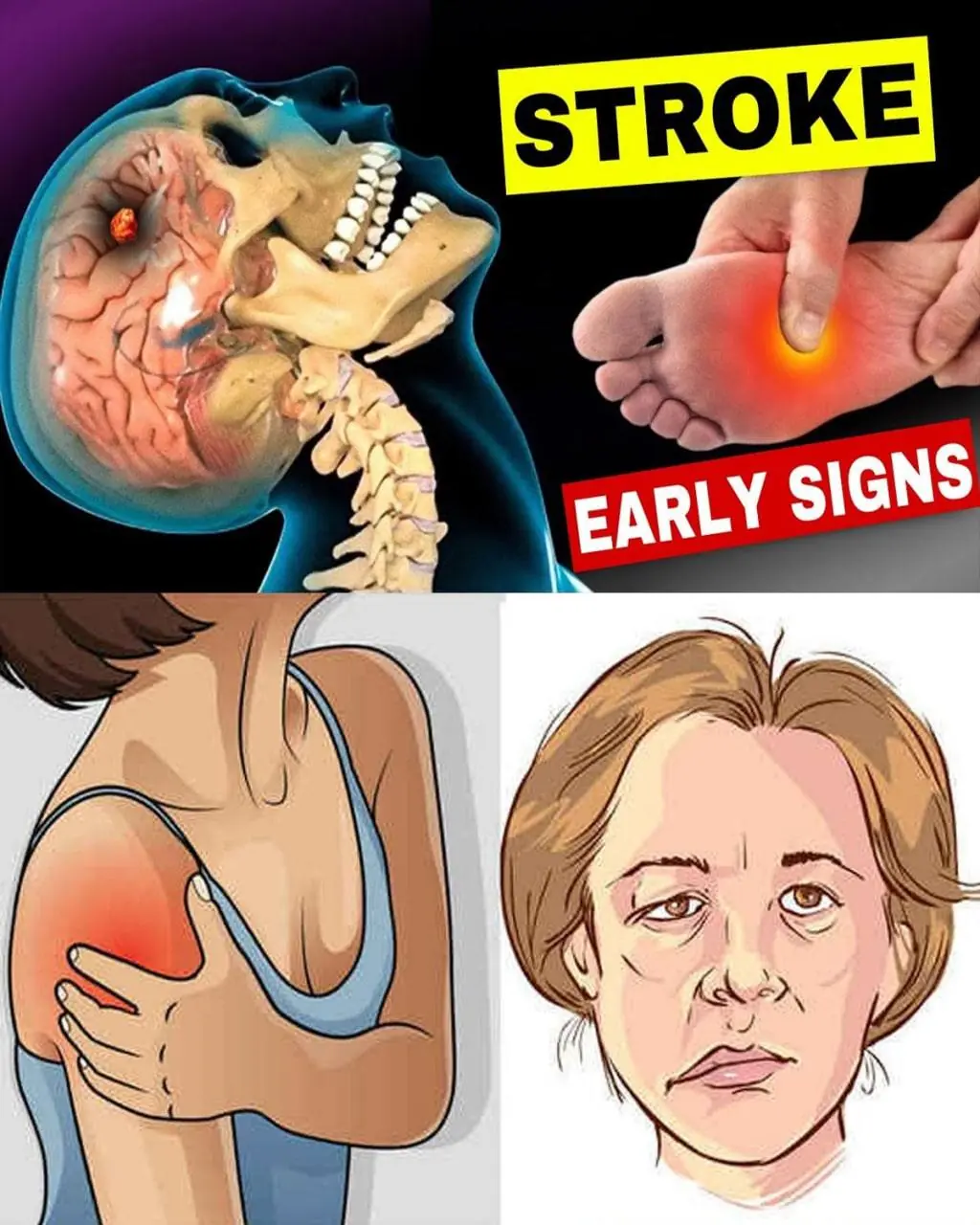 8 Warning Signs of Stroke That Can Appear Up to a Month Before — Plus 9 Proven Ways to Reduce Your Risk