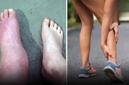 This Foot Symptom Could Mean Serious Damage — Don’t Ignore It