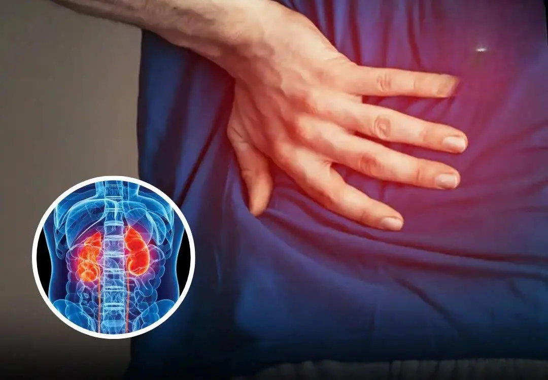 5 Silent Night Symptoms That May Indicate Kidney Dam:age