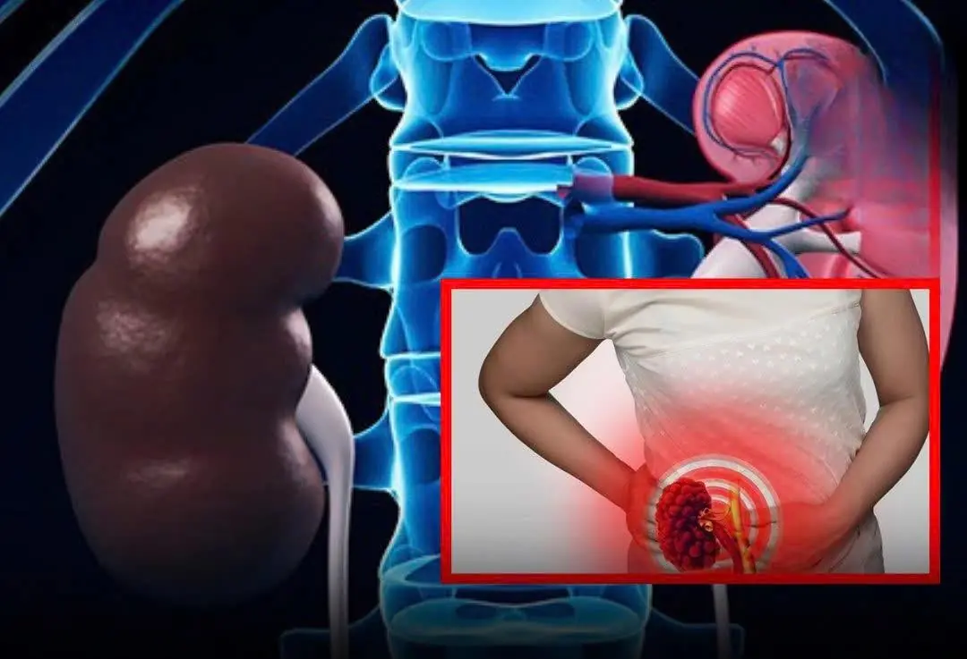 7 Signs Your Kidneys Are Working Well — Check Yourself
