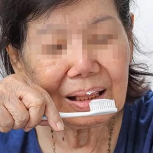 Brushing Teeth with Diluted Salt Water for a Year: What Happened Next?