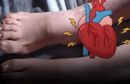 Your Feet May Show 6 Warning Signs Before a Heart Attack