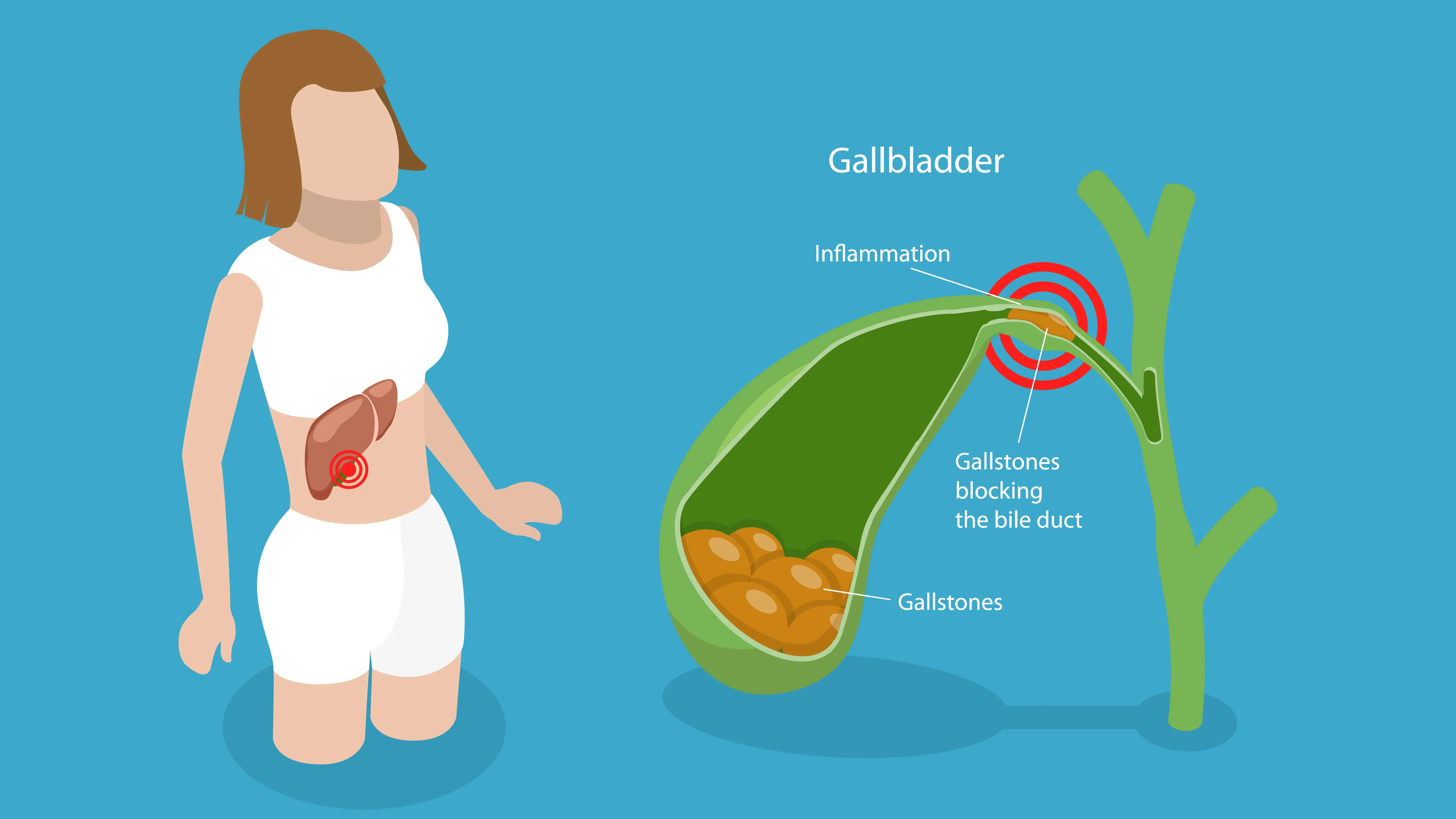 6 Hidden Signs of Gallbladder Cancer You Need to Know