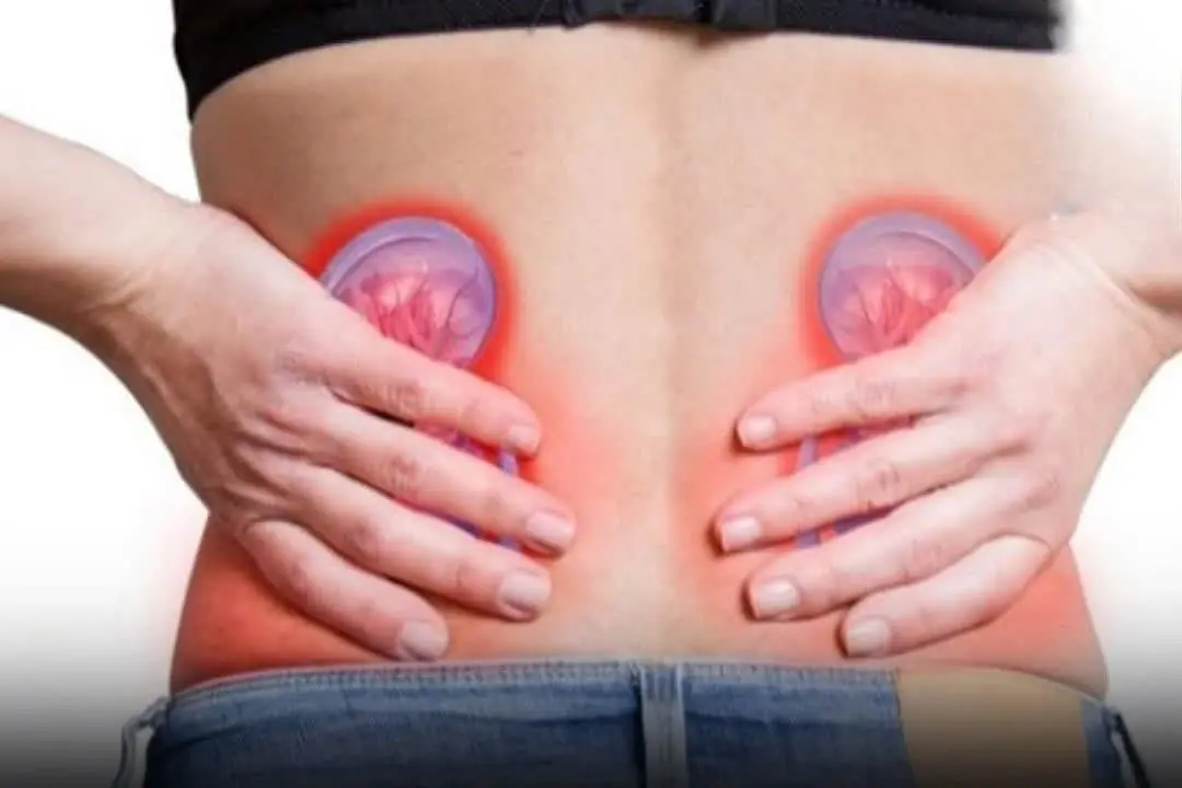 4 Simple Waters That Can Help Treat Kidney Stones Naturally