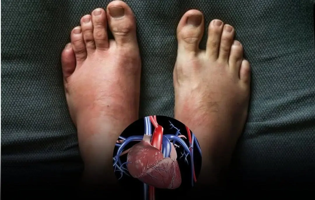 One Month Before A Heart At.tack, Your Body Will Warn You Of These 7 Signs