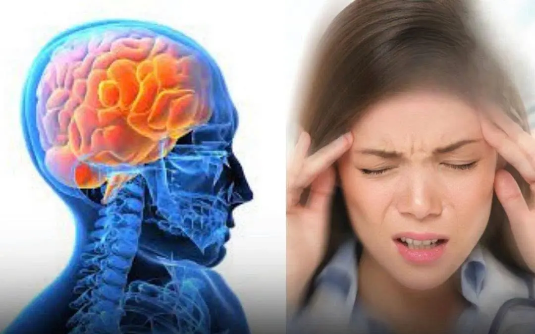 Young and at Risk: Str.ok.e Strikes 19-Year-Old After Headache — 5 Symptoms You Shouldn’t Ignore