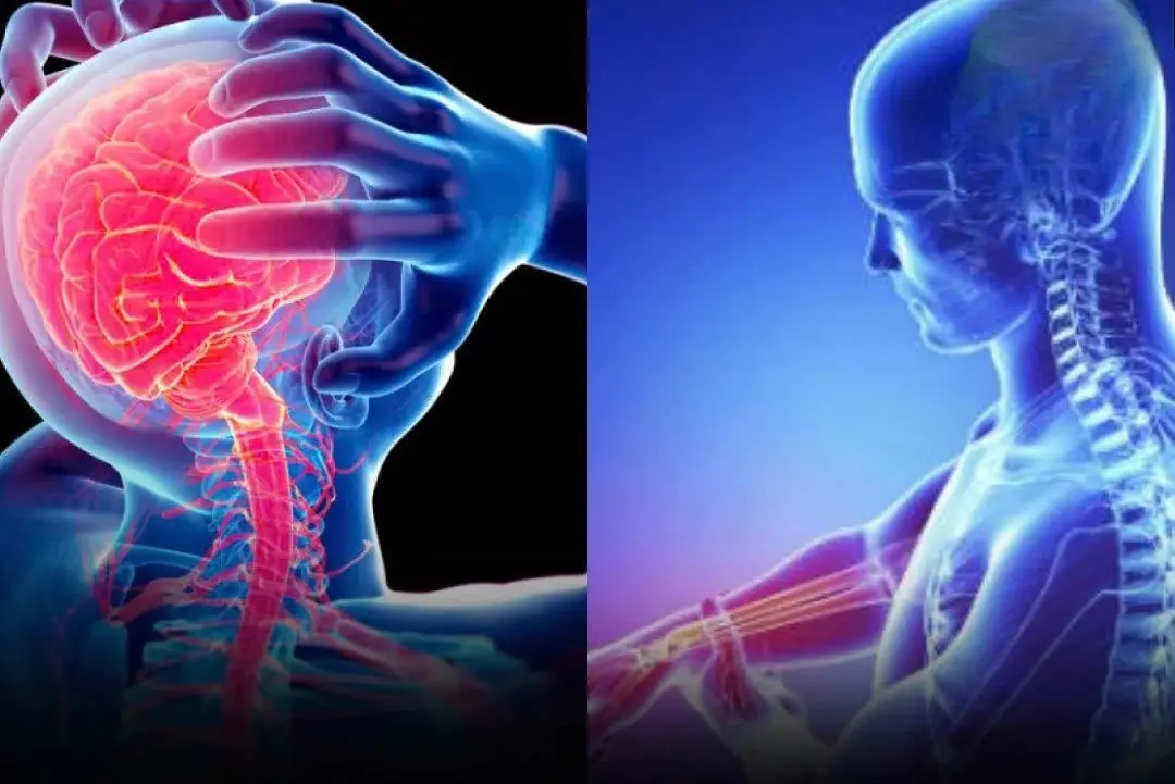 These are the symptoms nearly half of str:oke patients feel days before the att:ack