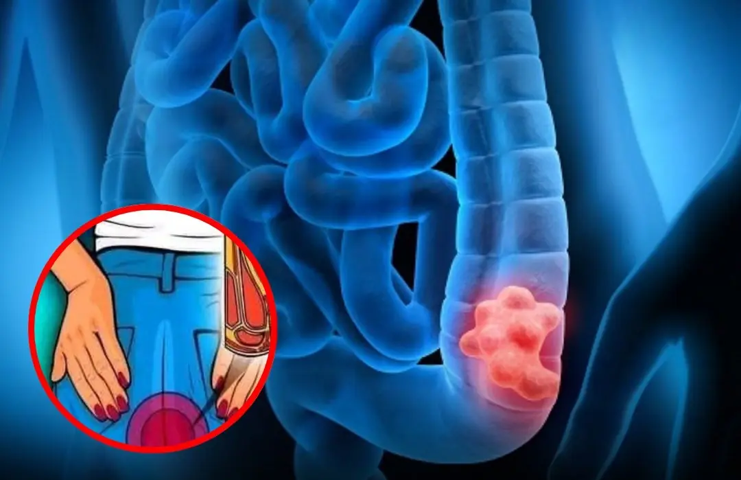 Everyday Habits That May Lead to Colon Cancer — Most People Don’t Notice Them