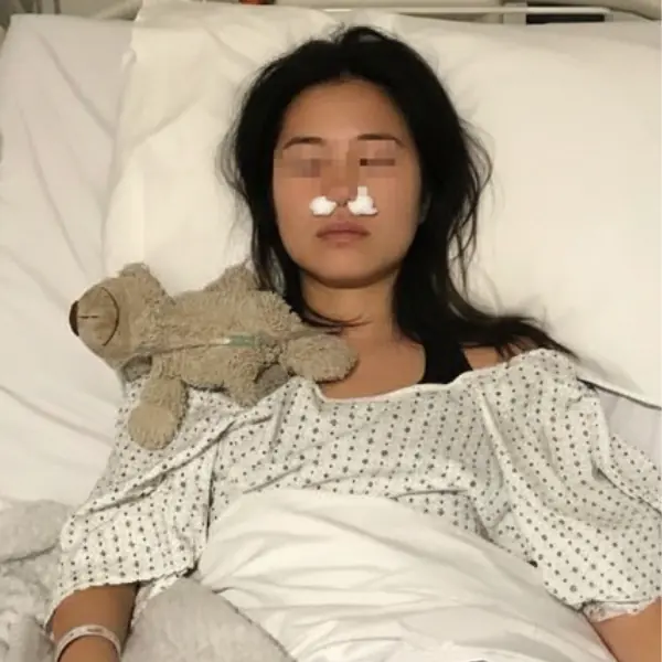 Woman Develops Fungal Growth Inside Her Nose: The Hidden Risk of a Common Habit