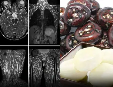 Eating Just One Bite is Already Harmful, But Many Still Eat It Without Worry