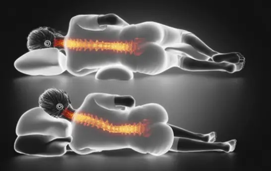 One simple sleep posture mistake could be twisting your neck and damaging your spine while you sleep