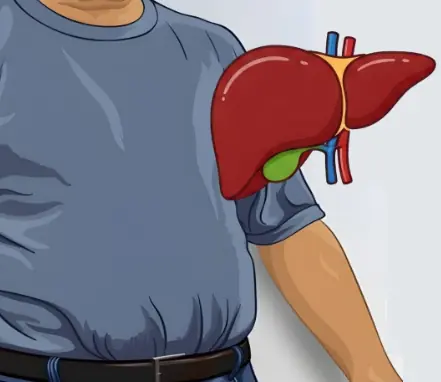 How to destroy your liver: 10 worst habits for fatty liver (hepatic steatosis)