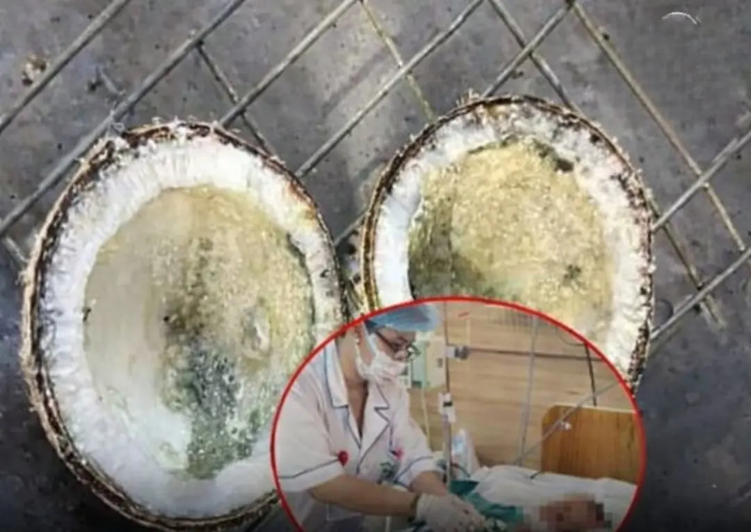 Sh.oc.king W.ar.ning: 69-Year-Old D.i.e.s After Drinking Coconut Water — One Common Mistake