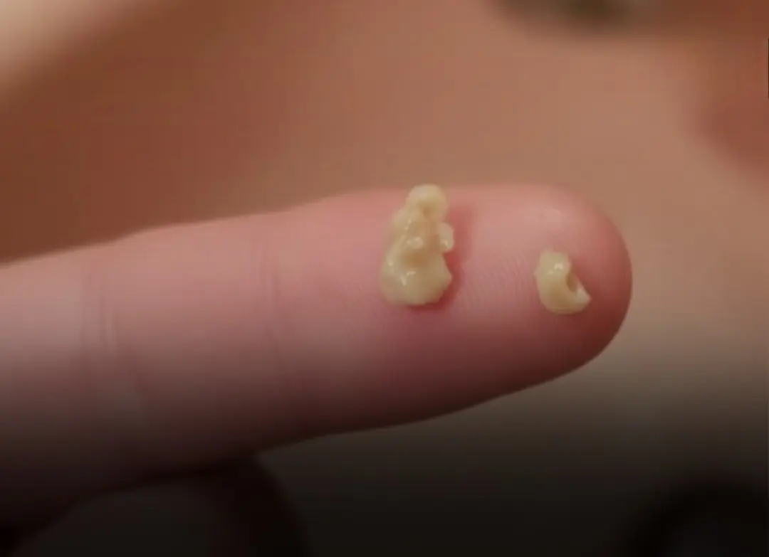 Here’s what you need to know...