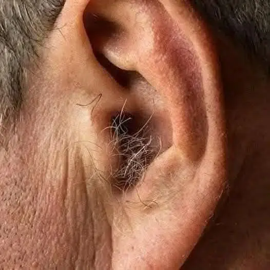 Did You Know? If Hair Grows on Your Ears, It May Be Linked to Changes in Your Body