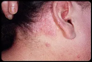 Think twice before sleeping with… here’s why