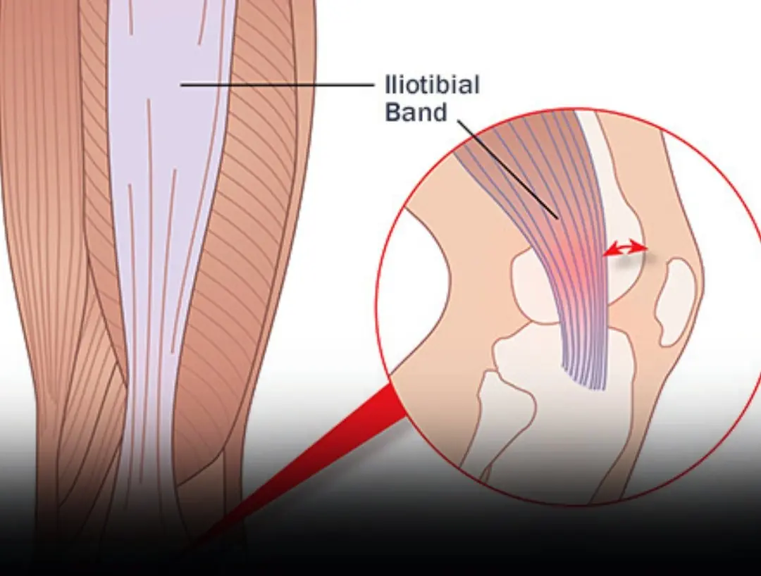 Feeling Pain Behind Your Knee? Here’s What You Should Know