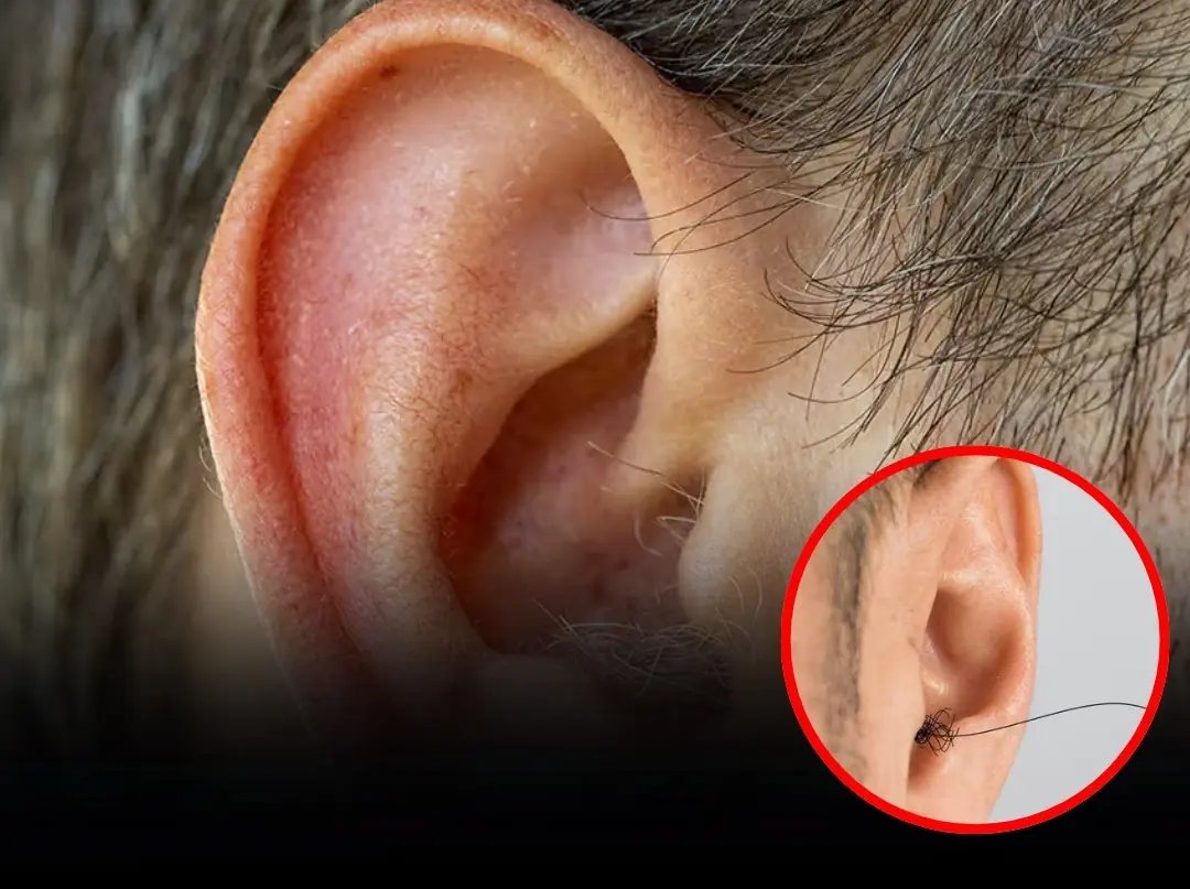 Noticed Hair Growing on Your Ears? Here’s What Could Be Behind It