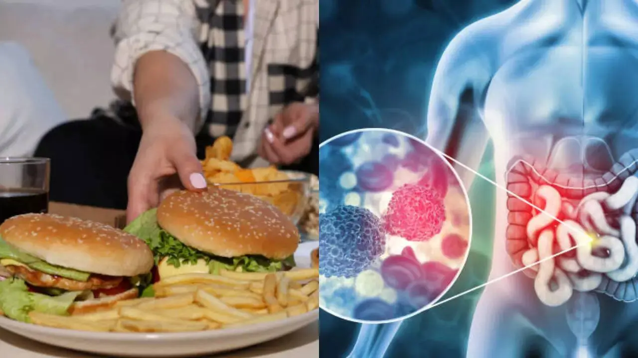 5 Foods That May Increase Your Risk of Sto.mach Can.cer When Consumed Excessively