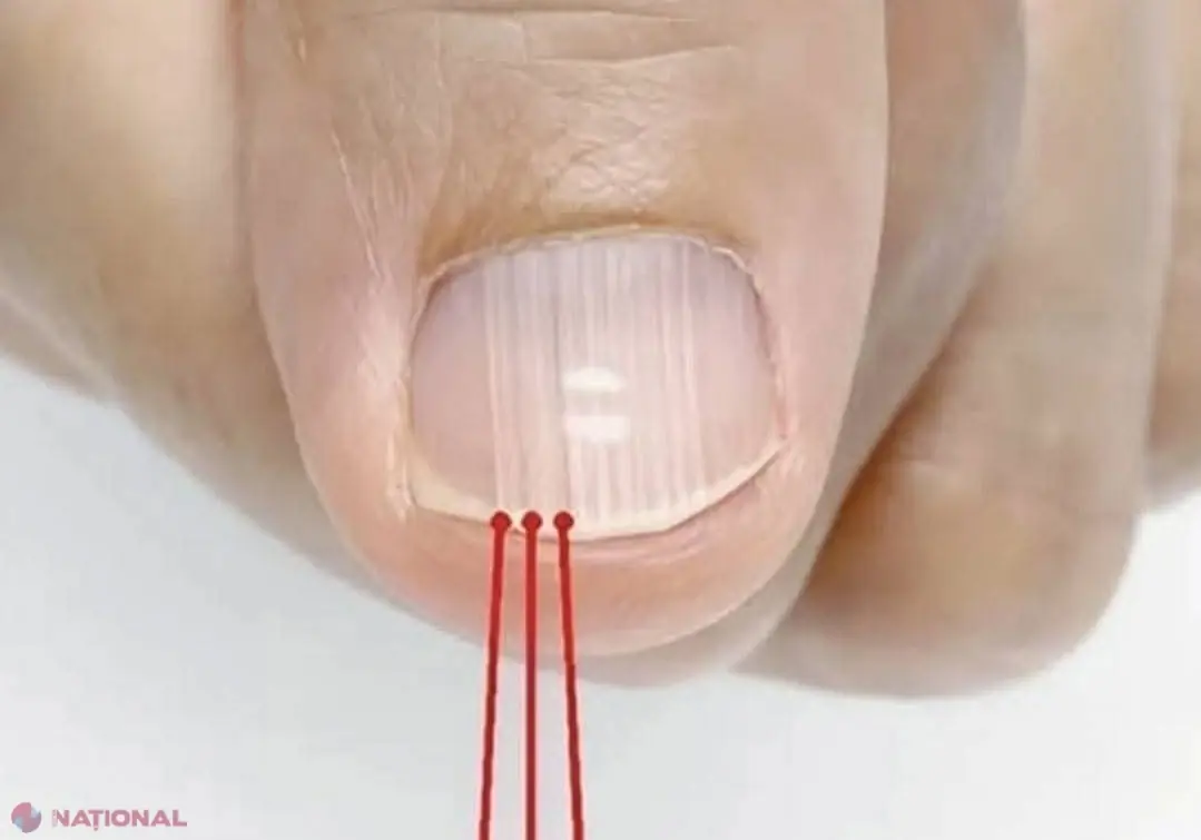 These Nail Changes After 40 Could Reveal Important Health Clues