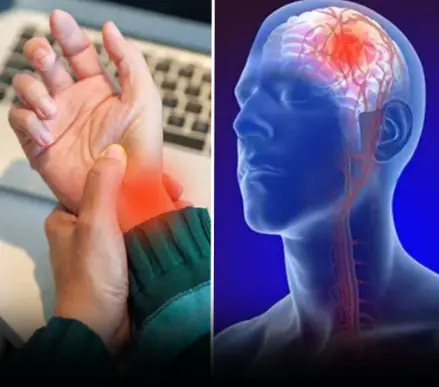 Recognizing Mini-Stroke Symptoms: A Crucial Step in Stroke Prevention