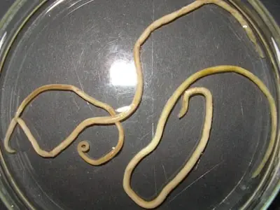 5 Common Vegetables That May Hide Tiny Worms — And How to Stay Safe