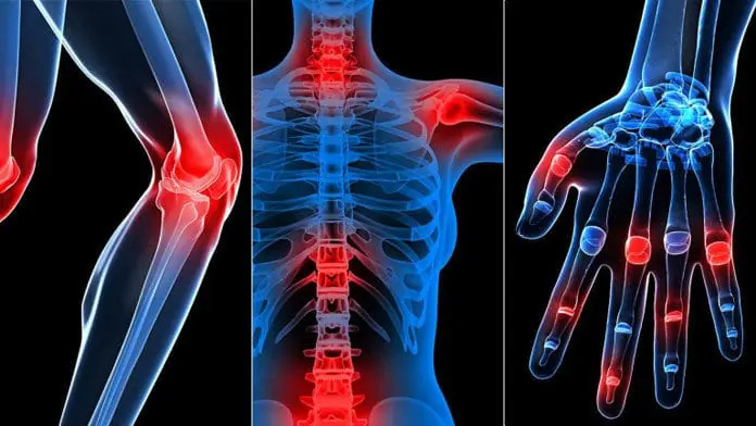 7 warning signs of arthritis you should never ignore