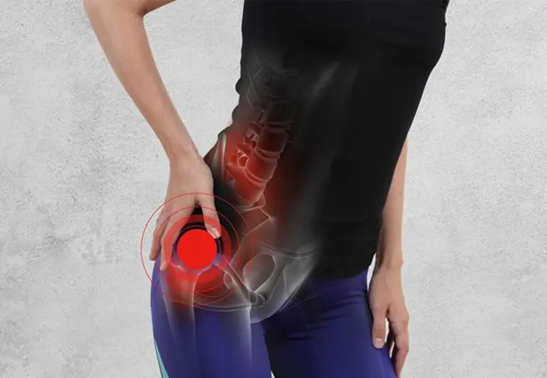 How to ease sciatica pain using natural methods