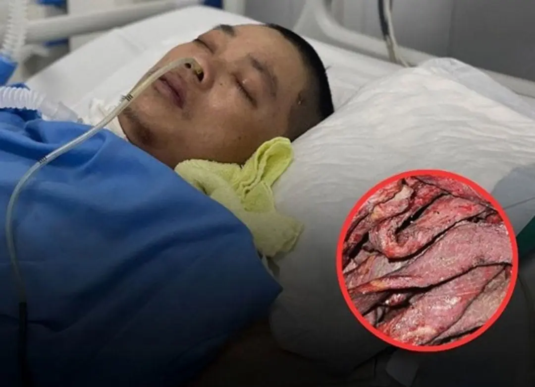 A type of meat that many people love and eat every day