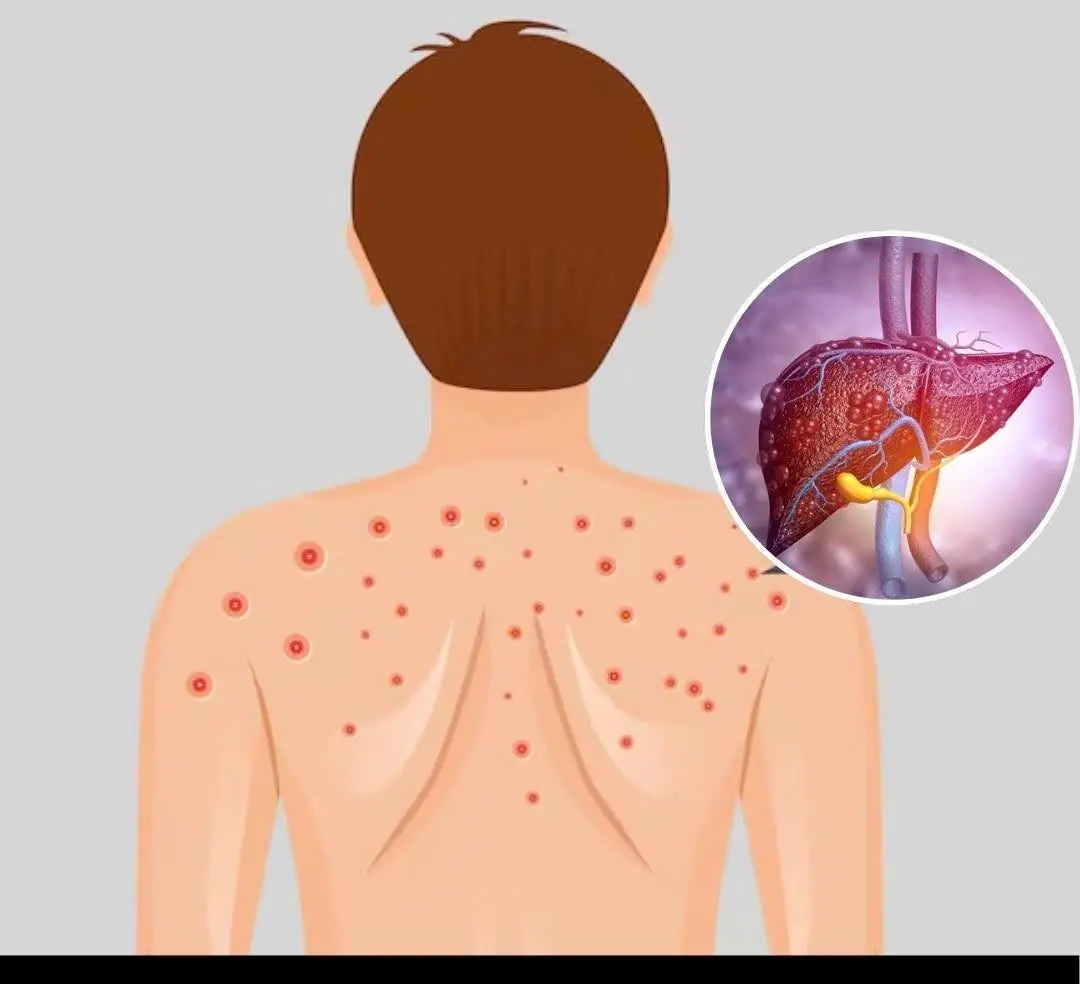 They can creep up on you!