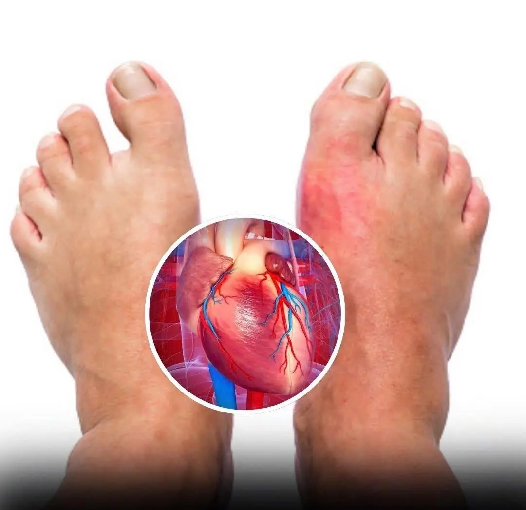 One month before a heart attack, your body will warn you of these 7 signs,