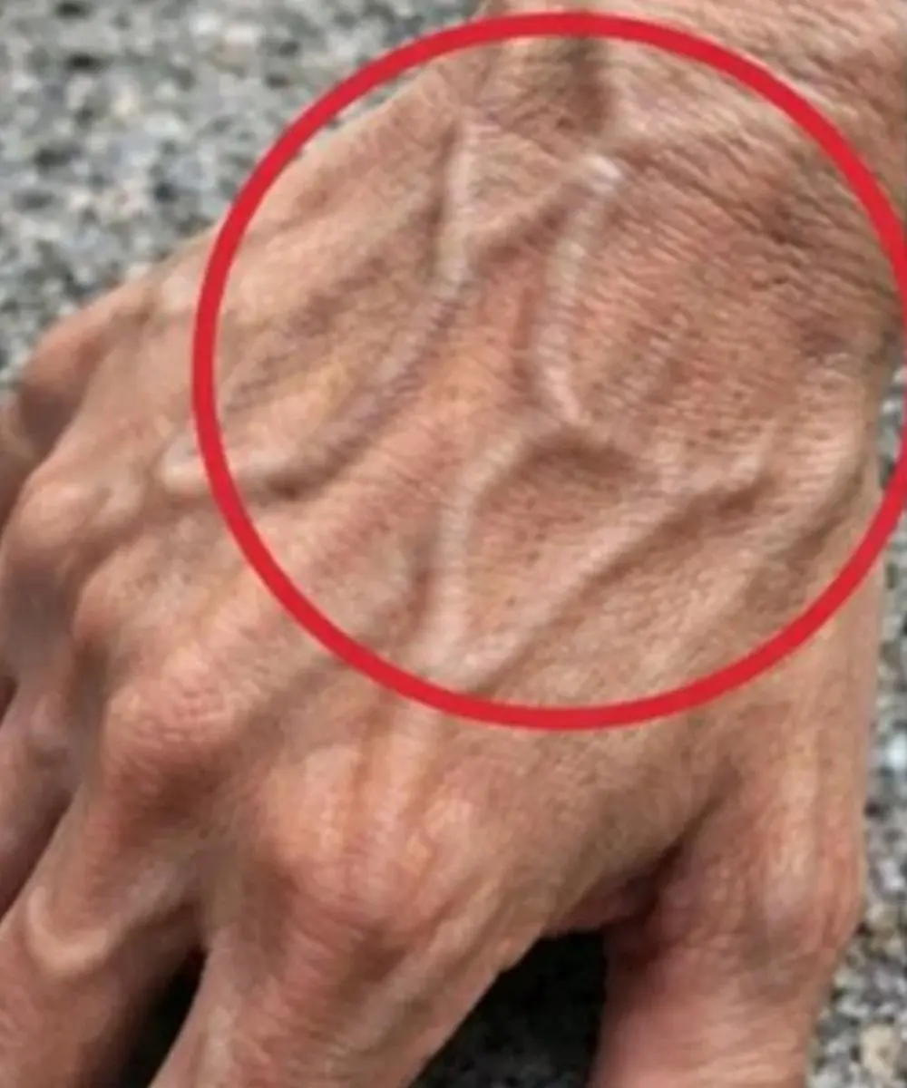 If Your Hand Veins Are Becoming More Visible, Here’s What It Might Mean for Your Body