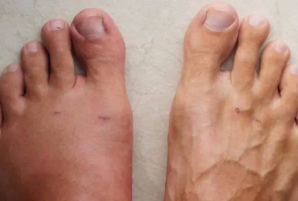 7 Warning Signs Your Body May Show Before a Heart Attack