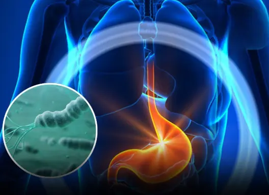 A Case Study: How a Daily Habit May Be Linked to Stomach Ulcers