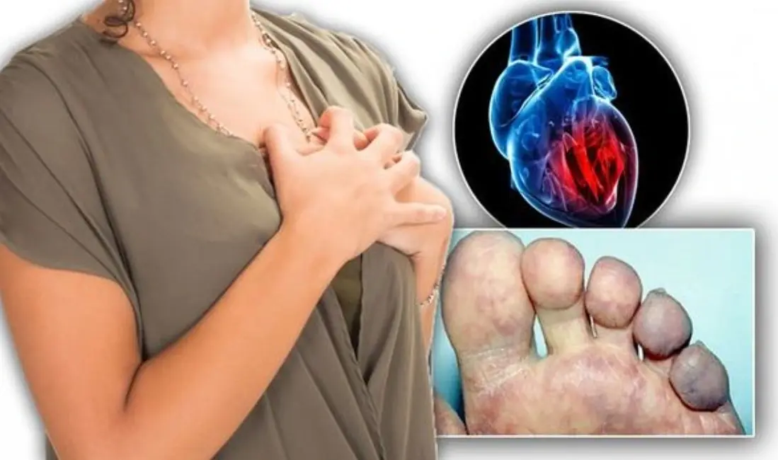 Your Body May Warn You Weeks Before a Heart Attack — Don’t Ignore These 7 Signs