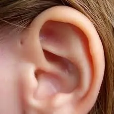 People With This Tiny Hole in Their Ear May Be More Unique Than You Think