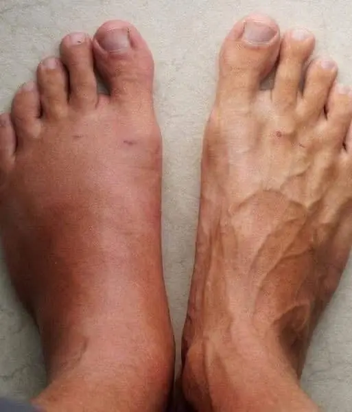 Up to a Month Before a Heart Attack: 7 Warning Signs Your Body May Send