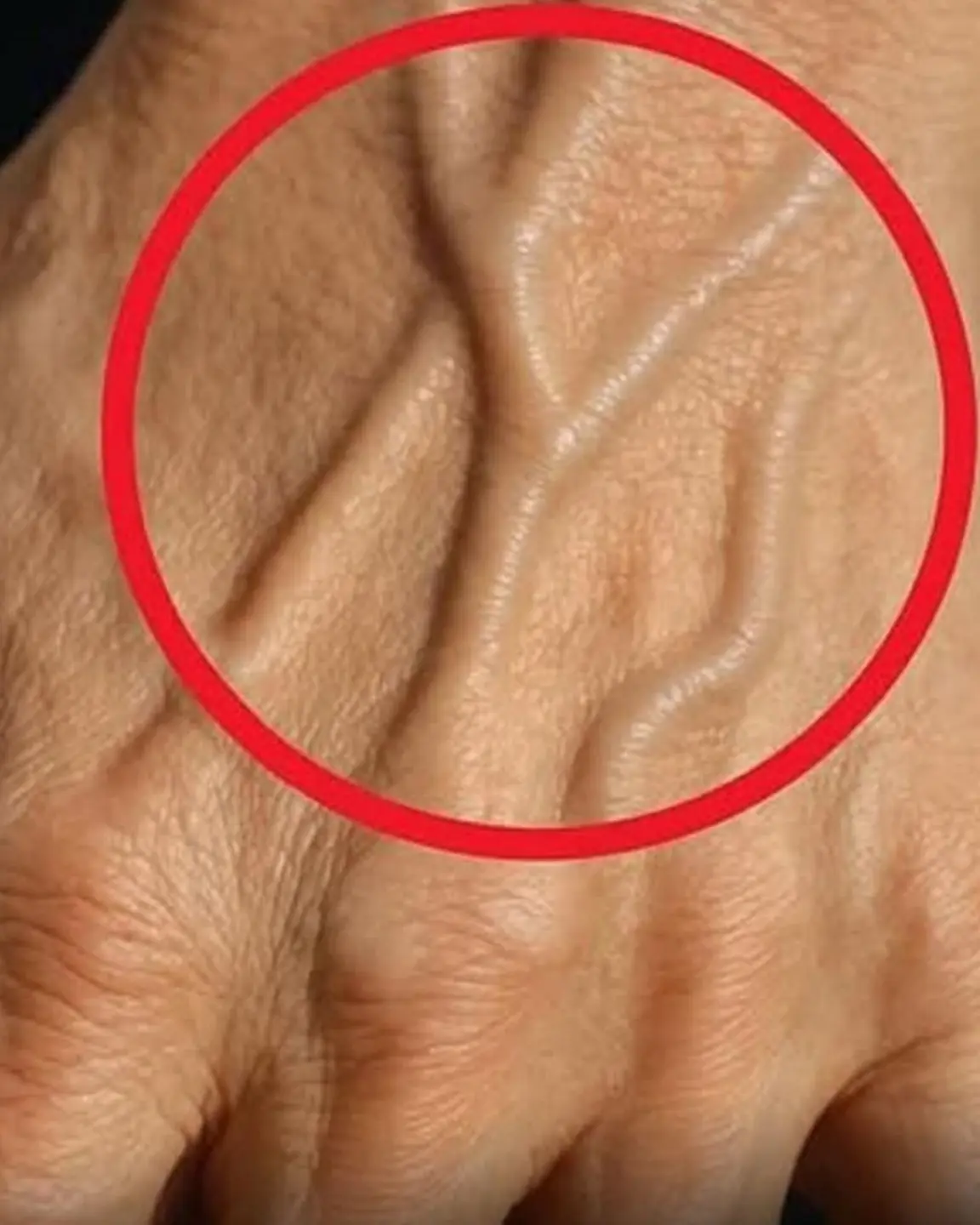 If you have visible veins, it doesn’t always mean the same thing — it depends on your body