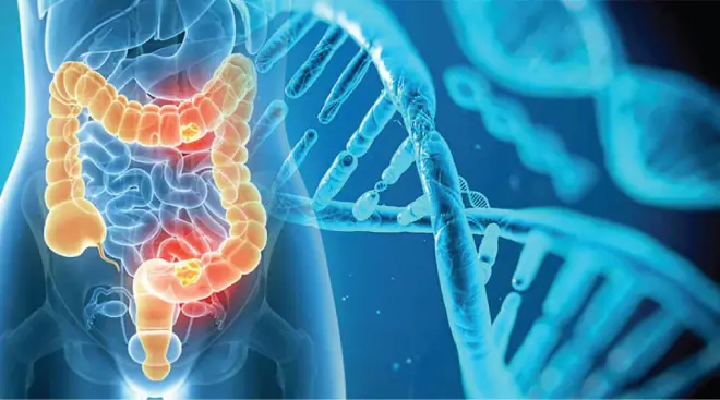 5 Red Flags You Shouldn’t Ignore When It Comes to Colon Can.cer