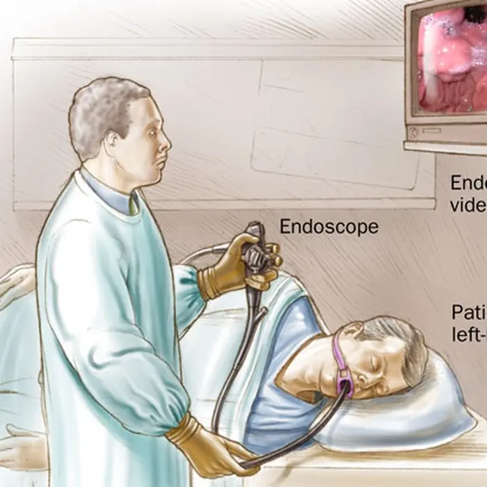 Doctor recommended a colonoscopy? Here’s what you can say and do next