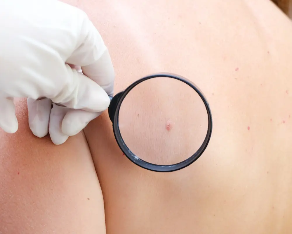 20 Possible Early Signs of Cancer You Shouldn’t Overlook