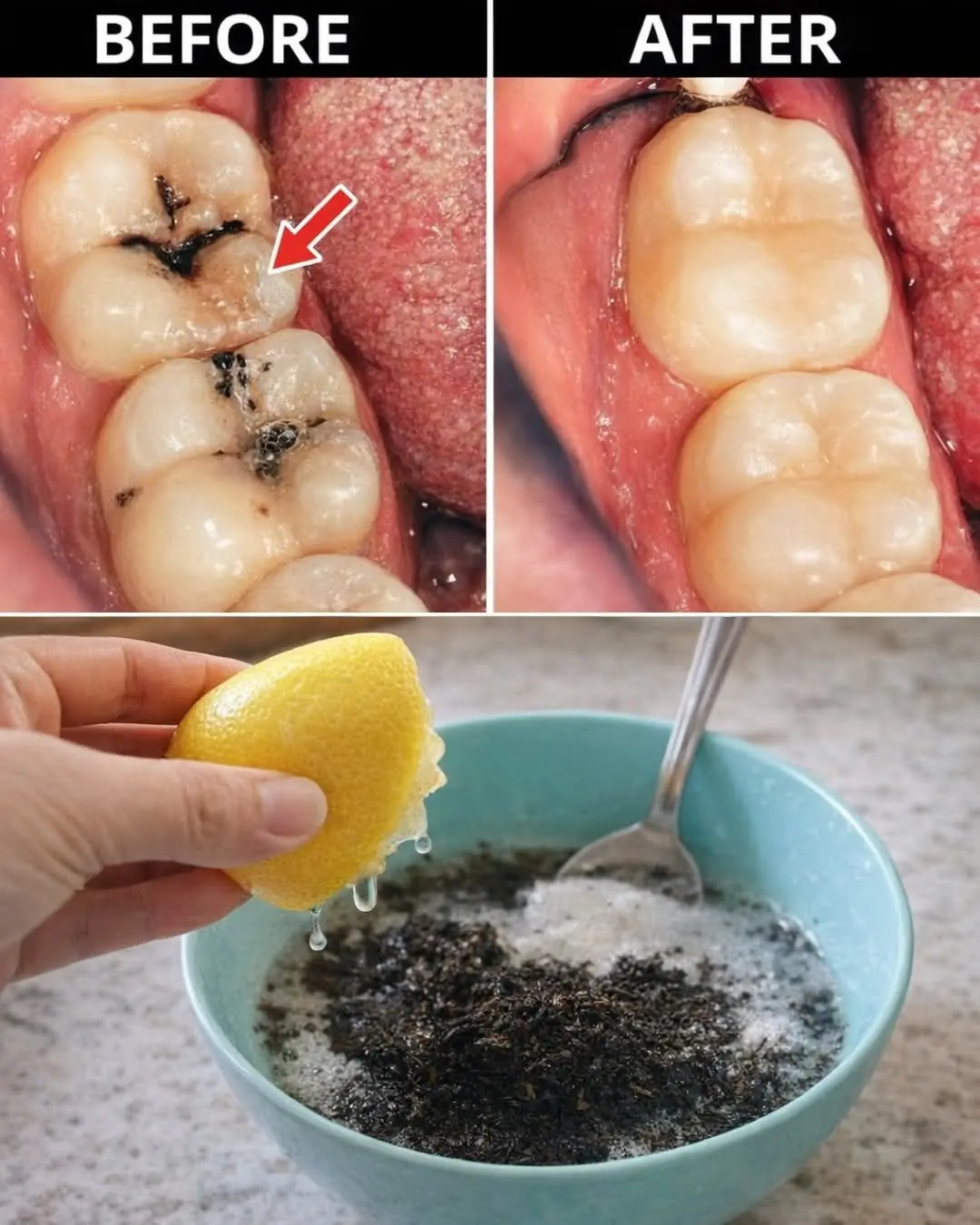 Before You Reach for the Drill… These Early Tooth Signals Might Still Be Reversible