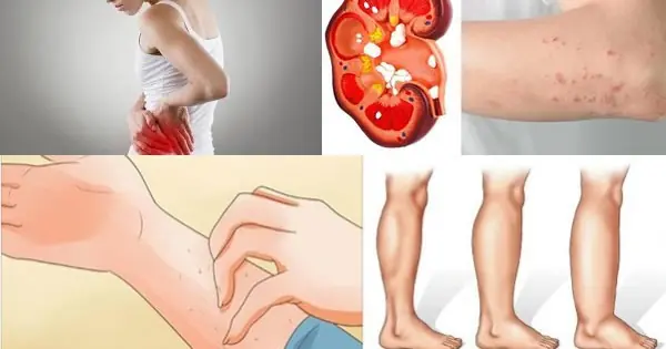 Your Body Is Trying to Tell You Something: 8 Signs of Kidney Danger