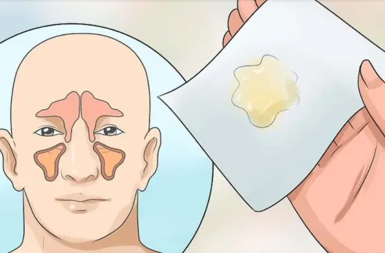 8 Ways To Get Rid Of Phlegm And Mucus In Chest And Throat
