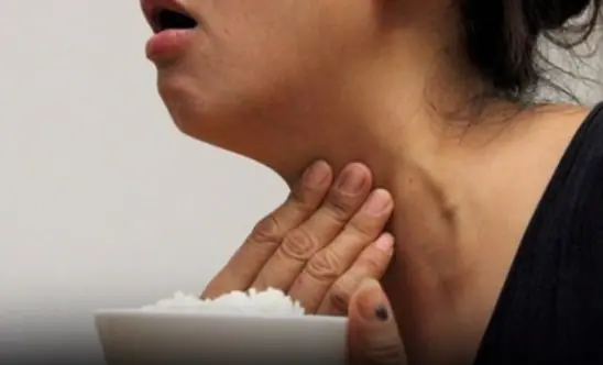 Suffering from a prolonged choking sensation, thought to be a stomach problem, the woman accidentally discovered that her thyroid gland had CAN.CER